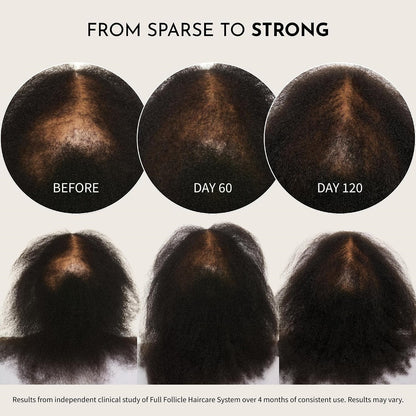 Maelove Full Follicle Advanced Scalp Serum with Peptides and Growth Factors